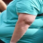 Можно ли получить инвалидность по ожирению в США?